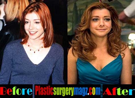 alyson hannigan breast implants|Alyson Hannigan Gushes Over Her ‘Insane’ Body  .